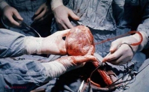 PREMIERĂ medicală! A fost realizat primul transplant reuşit al unei inimi care încetase să bată în corpul donatorului
