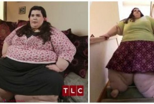 VIDEO // Medicul a refuzat să o opereze pe fată. După un an a revăzut-o și nu i-a venit să creadă