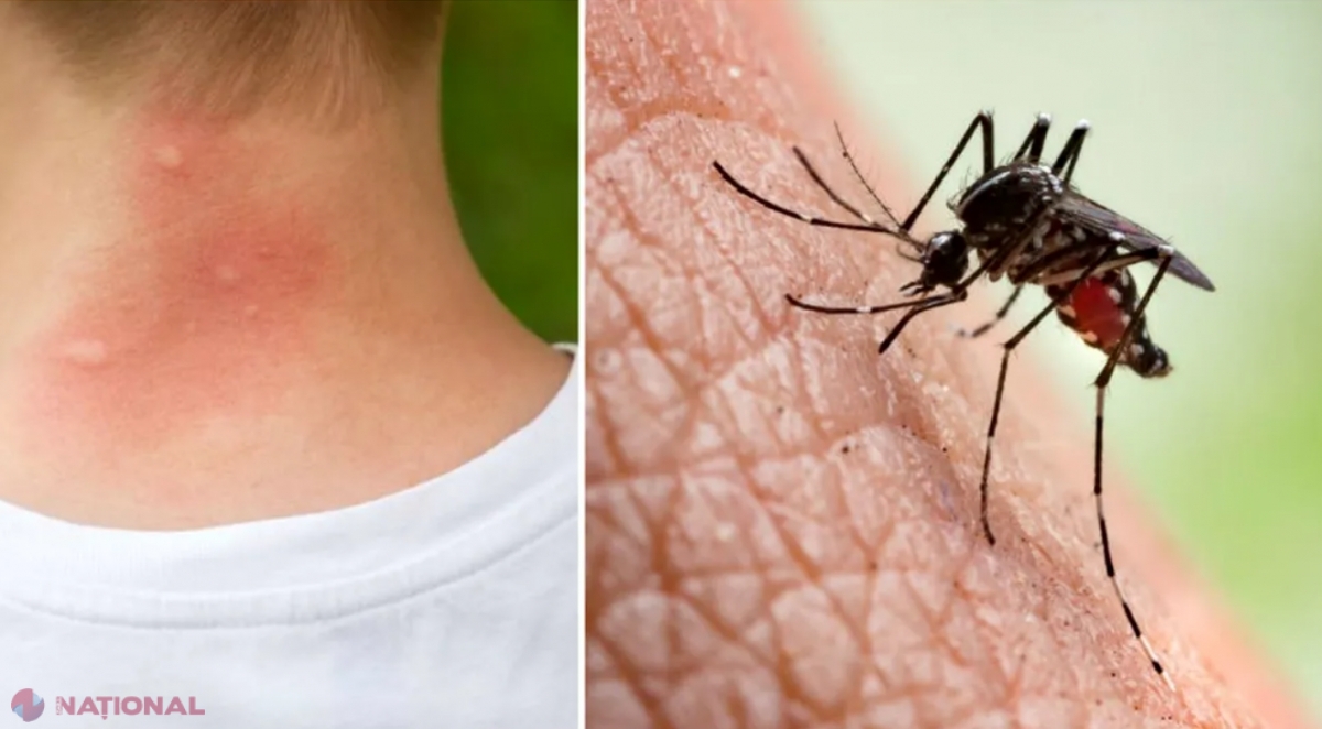 Why Do Mosquitoes Always Bite Me? Exploring the Factors that Attract Mosquitoes